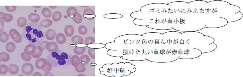 血球計数画像