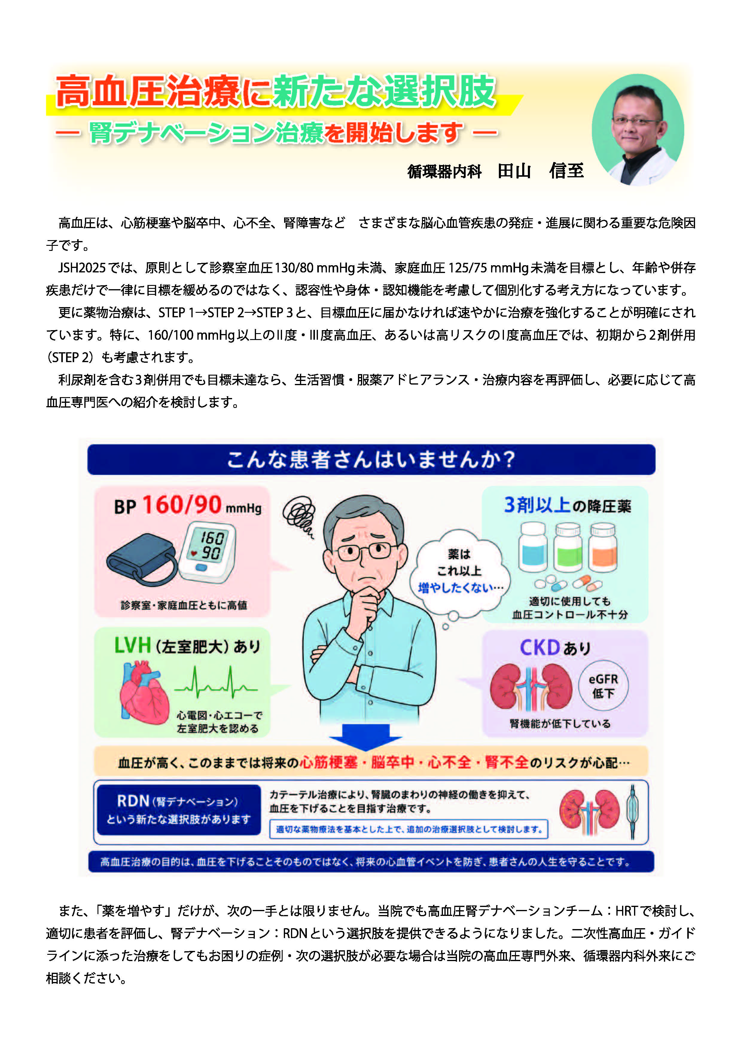 腎デナベーション