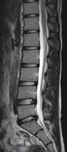 MRI